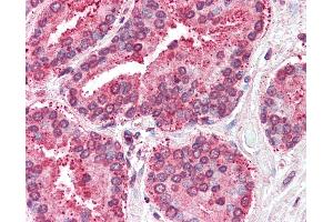 Anti-TSPAN6 antibody IHC of human prostate. (Tetraspanin 6 抗体  (Internal Region))