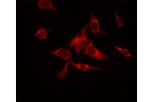 ABIN6266659 staining HuvEc by IF/ICC. (SENP7 抗体  (C-Term))
