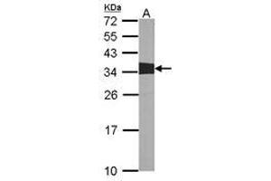 Image no. 1 for anti-V-Crk Sarcoma Virus CT10 Oncogene Homolog (Avian) (CRK) (AA 122-302) antibody (ABIN467422) (Crk 抗体  (AA 122-302))