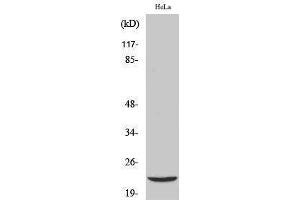Western Blotting (WB) image for anti-Parkinson Protein 7 (PARK7) (Internal Region) antibody (ABIN3184312) (PARK7/DJ1 抗体  (Internal Region))