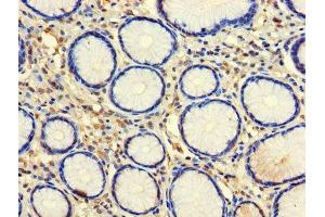 Immunohistochemistry of paraffin-embedded human stomach tissue using ABIN7146057 at dilution of 1:100 (CLEC18A 抗体  (AA 27-446))