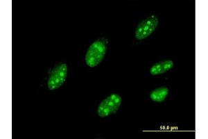 Immunofluorescence of monoclonal antibody to IQGAP3 on HeLa cell. (IQGAP3 抗体  (AA 602-698))