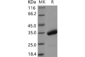 Western Blotting (WB) image for Serine Peptidase Inhibitor, Kazal Type 4 (SPINK4) protein (Fc Tag) (ABIN7320100) (SPINK4 Protein (Fc Tag))