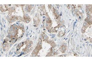ABIN6278655 at 1/100 staining Human prostate tissue by IHC-P.