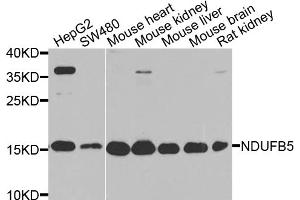 Western blot analysis of extracts of various cell lines, using NDUFB5 antibody. (NDUFB5 抗体)