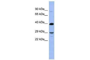 OLIG3 antibody used at 5 ug/ml to detect target protein. (OLIG3 抗体  (N-Term))