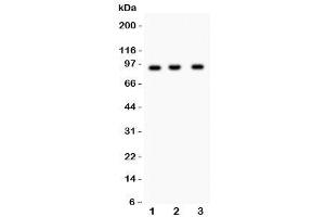 Western blot testing of NEDD9 antibody and Lane 1:  Jurkat (NEDD9 抗体)