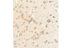 Immunohistochemistry of paraffin embedded rat brain using rasgrf1 (ABIN7073422) at dilution of 1:4000 (400x lens) (Cdc25 抗体)