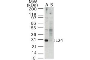 Western blot analysis of IL24 in the A) absence and B) presence of blocking peptide in Jurkat cell lysate. (IL-24 抗体  (AA 100-150))