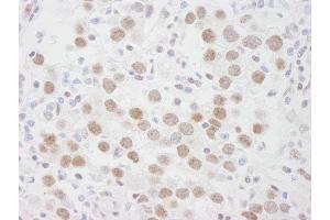 Immunohistochemistry (IHC) image for anti-DEAD (Asp-Glu-Ala-Asp) Box Polypeptide 1 (DDX1) (AA 500-550) antibody (ABIN7448512) (DDX1 抗体  (AA 500-550))