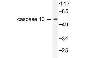 Image no. 1 for anti-Caspase 10, Apoptosis-Related Cysteine Peptidase (CASP10) antibody (ABIN265334) (Caspase 10 抗体)