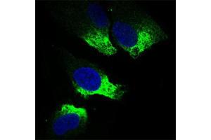 Immunocytochemistry (ICC) image for anti-Twist Homolog 1 (Drosophila) (TWIST1) (AA 9-74) antibody (ABIN1842915)