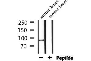 Western blot analysis of extracts from mouse heart, using TOP1 Antibody. (Topoisomerase I 抗体  (Internal Region))