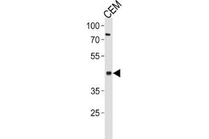 Western Blotting (WB) image for anti-Fatty Acid Desaturase 2 (FADS2) antibody (ABIN3002322) (FADS2 抗体)