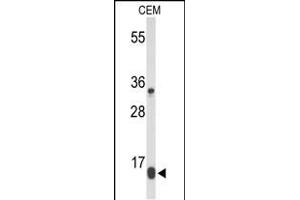 Western blot analysis of DIRAS1 Antibody (Center) (ABIN653351 and ABIN2842831) in CEM cell line lysates (35 μg/lane). (DIRAS1 抗体  (AA 109-136))