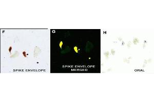IHC Validation in COVID-19 Patient Sample: (Nuovo et al. (SARS-CoV-2 Envelope 抗体  (N-Term))