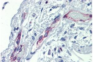 Lung, Human: Formalin-Fixed, Paraffin-Embedded (FFPE) (EHD4 抗体  (AA 396-445))