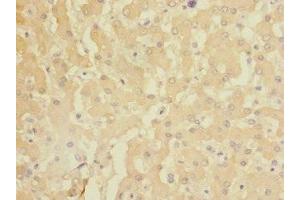 Immunohistochemistry of paraffin-embedded human liver tissue using ABIN7154473 at dilution of 1:100 (GADD45G 抗体  (AA 1-159))