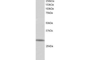 ABIN184998 staining (1 ug/ml) of Human Testis lysate (RIPA buffer, 30 ug total protein per lane). (RNF141 抗体  (C-Term))