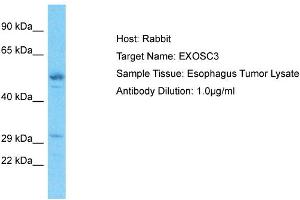 Host: Rabbit Target Name: EXOSC3 Sample Type: Esophagus Tumor lysates Antibody Dilution: 1. (EXOSC3 抗体  (C-Term))