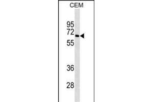 BLNK Antibody ABIN1539928 western blot analysis in CEM cell line lysates (35 μg/lane). (B-Cell Linker 抗体  (AA 150-178))