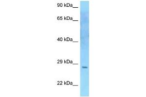 WB Suggested Anti-SOCS2 Antibody Titration: 1.