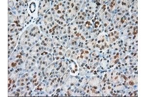 Immunohistochemical staining of paraffin-embedded Adenocarcinoma of Human colon tissue using anti-USP5 mouse monoclonal antibody. (USP5 抗体)