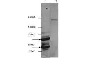 Western Blot of Rabbit anti-HDAC2 antibody. (HDAC2 抗体  (C-Term))
