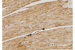 ABIN6274489 at 1/100 staining Rat heart tissue by IHC-P. (DUSP9 抗体  (Internal Region))