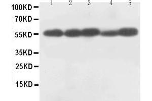 Western Blotting (WB) image for anti-Caspase 8 (CASP8) (AA 240-259), (Middle Region) antibody (ABIN3044361) (Caspase 8 抗体  (Middle Region))