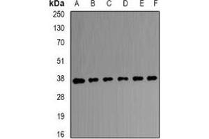 Western blot analysis of Transaldolase expression in HEK293T (A), A431 (B), SW480 (C), mouse brain (D), mouse kidney (E), rat liver (F) whole cell lysates.