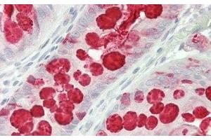 Detection of TFF3 in Human Colon Tissue using Polyclonal Antibody to Trefoil Factor 3 (TFF3) (TFF3 抗体  (AA 22-80))
