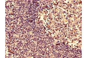 Immunohistochemistry (IHC) image for anti-Actin Related Protein 2/3 Complex, Subunit 3, 21kDa (ARPC3) (AA 2-175) antibody (ABIN7143089)