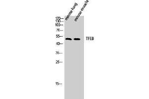 Western Blotting (WB) image for anti-Transcription Factor EB (TFEB) (N-Term) antibody (ABIN3177684) (TFEB 抗体  (N-Term))