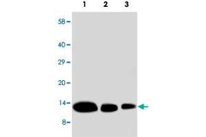 Western blot analysis of recombinate human CXCL9 protein with CXCL9 polyclonal antibody . (CXCL9 抗体  (N-Term))
