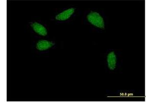 Immunofluorescence of purified MaxPab antibody to TCF2 on HeLa cell. (HNF1B 抗体  (AA 1-557))