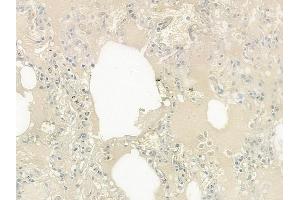 ABIN6257619 and ABIN6275298 at 1/100 staining human normal lung tissue by IHC-P. (Neurexophilin 4 抗体  (Internal Region))