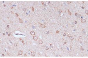 Immunohistochemistry of paraffin-embedded Rat brain using CARTPT Polyclonal Antibody at dilution of 1:100 (40x lens). (CARTPT 抗体)