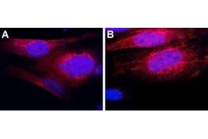 Expression of Thyrotropin-releasing hormone receptor 1 in mouse MS1 cellsImmunocytochemical staining of mouse pancreatic islet endothelial (MS1) cells. (TRHR 抗体  (Intracellular))