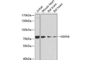 Western blot analysis of extracts of various cell lines using HSPA6 Polyclonal Antibody at dilution of 1:1000. (HSPA6 抗体)