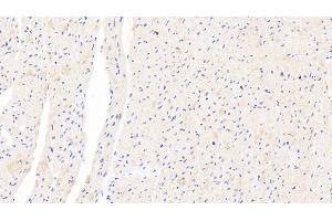 Detection of XRN1 in Human Cardiac Muscle Tissue using Polyclonal Antibody to 5'-3'Exoribonuclease 1 (XRN1) (XRN1 抗体  (AA 1394-1706))