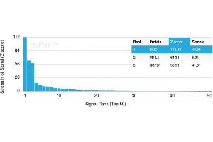 Analysis of Protein Array containing more than 19,000 full-length human proteins using Dystrophin Monospecific Mouse Monoclonal Antibody (DMD/3245). (Dystrophin 抗体  (AA 114-263))
