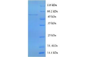 SDS-PAGE (SDS) image for Multiple Inositol-Polyphosphate Phosphatase 1 (MINPP1) (AA 31-481) protein (His tag) (ABIN5709933)