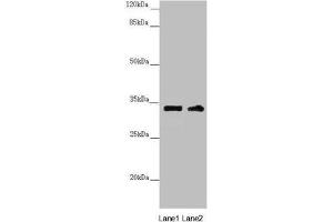 Western blot All lanes: CENPK antibody at 3. (CENPK 抗体  (AA 1-269))
