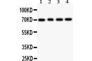 Anti- FOXO1A antibody, Western blotting All lanes: Anti FOXO1A  at 0. (FOXO1 抗体  (AA 456-655))