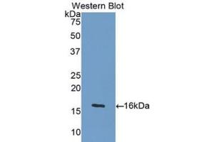 Western blot analysis of the recombinant protein. (GDF5 抗体  (AA 382-501))