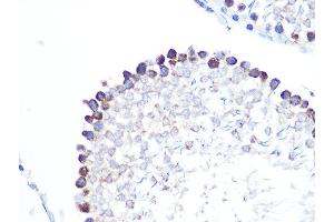 Immunohistochemistry (IHC) image for anti-Stathmin 1 (STMN1) antibody (ABIN1678518)