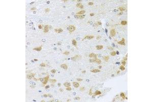 Immunohistochemistry of paraffin-embedded mouse brain using Gm13125 antibody. (Pramel15 抗体  (AA 67-274))