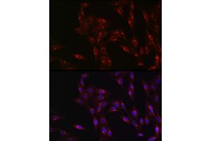 Immunofluorescence analysis of NIH/3T3 cells using MR1 Rabbit pAb (ABIN6131925, ABIN6143983, ABIN6143984 and ABIN6224070) at dilution of 1:100 (40x lens). (MR1 抗体  (AA 20-260))