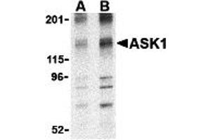 Western Blotting (WB) image for anti-Mitogen-Activated Protein Kinase Kinase Kinase 5 (MAP3K5) (N-Term) antibody (ABIN1031241) (ASK1 抗体  (N-Term))